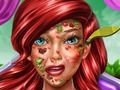 Παιχνίδι Princess Mermaid: Skin Doctor  σε απευθείας σύνδεση