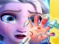 Παιχνίδι Elsa Hand Doctor σε απευθείας σύνδεση
