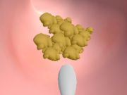 Παιχνίδι Κλινική Earwax σε απευθείας σύνδεση