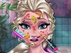 Ice Queen Skin Doctor — δωρεάν online παιχνίδι