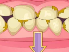 Bad Teeth Makeover — δωρεάν online παιχνίδι