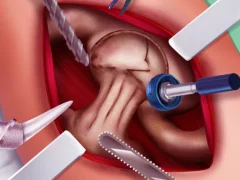 Princess Hips Surgery — δωρεάν online παιχνίδι