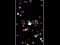 Pop Ball — δωρεάν online παιχνίδι