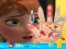 Anna hand doctor — δωρεάν online παιχνίδι