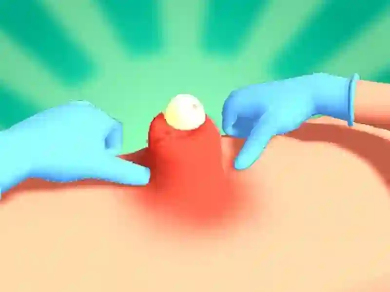 Pimple Squeeze — δωρεάν online παιχνίδι