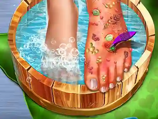 Feet Skin Doctor — δωρεάν online παιχνίδι