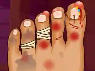 Monster Foot Doctor — δωρεάν online παιχνίδι