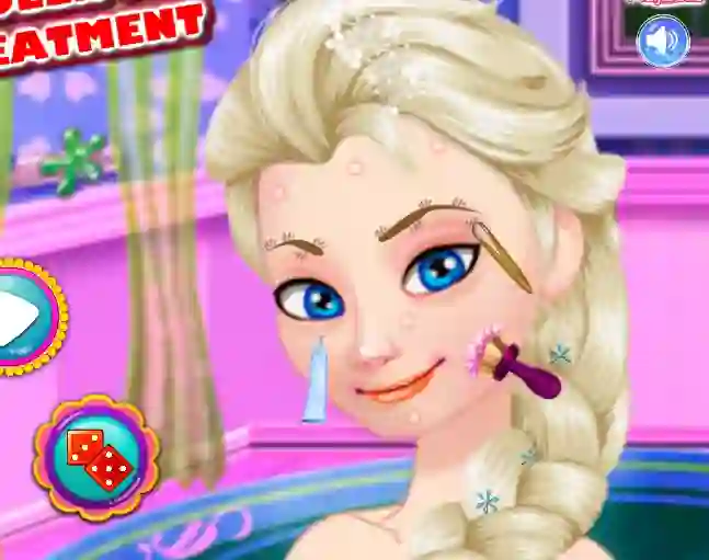 Ice Queen Acne Treatment — δωρεάν online παιχνίδι