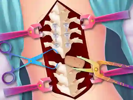 Anna Scoliosis Surgery — δωρεάν online παιχνίδι