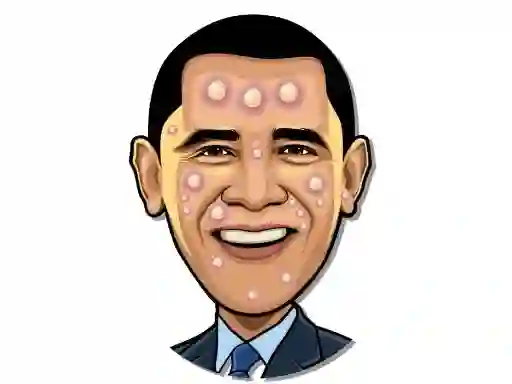 Celebrity Pimple Pop — δωρεάν online παιχνίδι