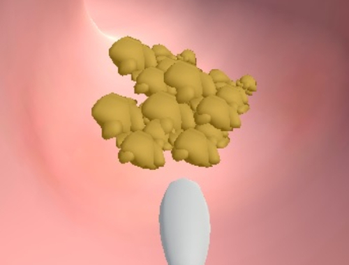 Παιχνίδι Κλινική Earwax σε απευθείας σύνδεση